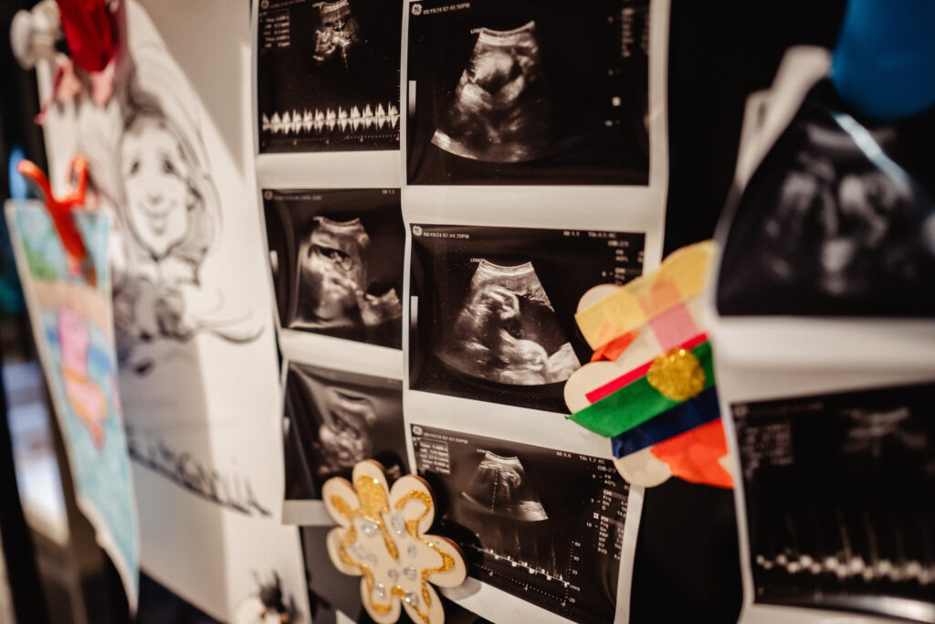 Baby sonogram from ultrasound hanging on the fridge captured during birth photography