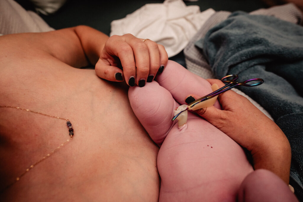 Cutting newborn baby's umbilical cord following home birth